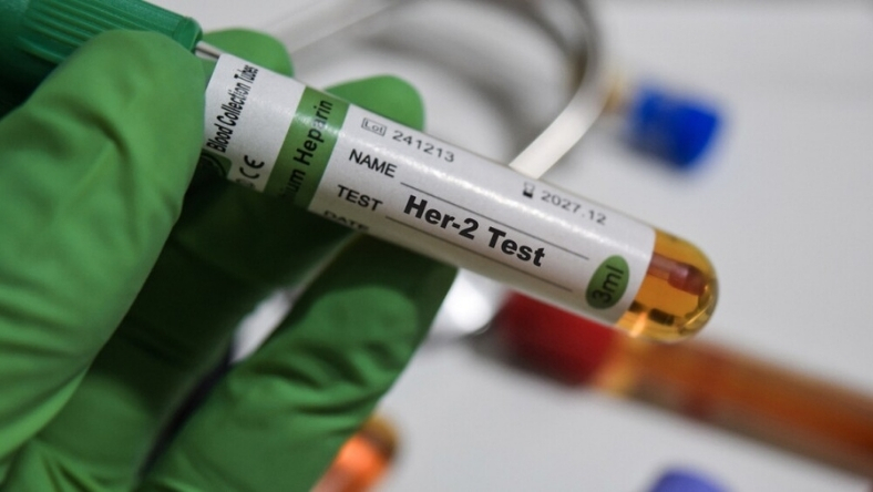 Close-up of Her-2 test tube labeled sample in gloved hand